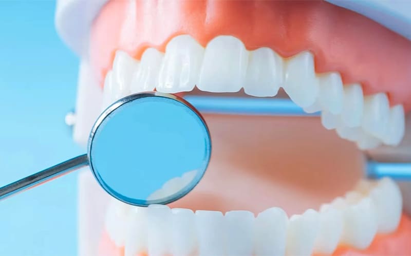 歯周病治療について