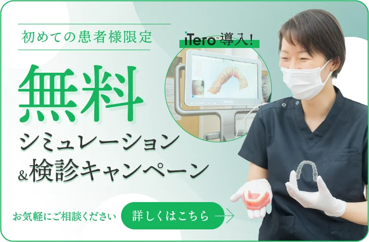 iTero無料シミュレーション実施中
