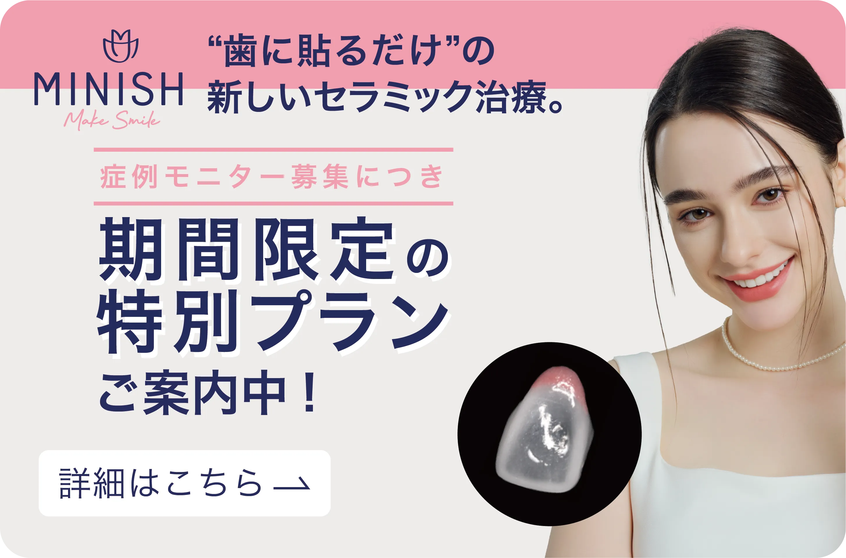 ミニッシュ